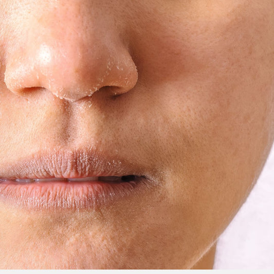 Plusminus Normal skincare dry dehydrated rough itchy skin sensitive